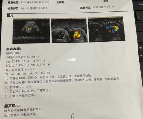 胎儿心脏卵圆孔正常值(胎儿心脏卵圆孔正常值是多少?) 第3张 胎儿心脏卵圆孔正常值(胎儿心脏卵圆孔正常值是多少?) 第3张
