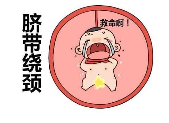 孕宝宝脐带绕颈怎么办?脐带绕颈对胎儿有什么坏处,胎儿脐带绕腹有影响吗图片 第2张 孕宝宝脐带绕颈怎么办?脐带绕颈对胎儿有什么坏处,胎儿脐带绕腹有影响吗图片 第2张