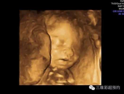 胎儿超声波检查是什么(胎儿系统超声检查和四维是一回事儿吗) 第2张 胎儿超声波检查是什么(胎儿系统超声检查和四维是一回事儿吗) 第2张