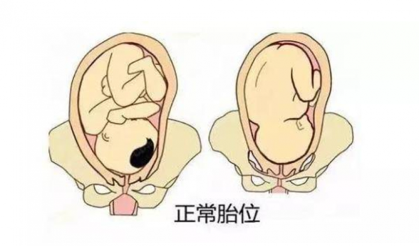 怀孕28周胎儿的头在哪(怀孕28周胎儿的头在哪) 第1张 怀孕28周胎儿的头在哪(怀孕28周胎儿的头在哪) 第1张