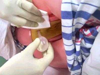 孕妇便秘大便堵在肛门可以用开塞露吗,孕期便秘严重用开塞露对宝宝有影响吗 第3张 孕妇便秘大便堵在肛门可以用开塞露吗,孕期便秘严重用开塞露对宝宝有影响吗 第3张