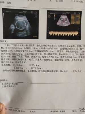 孕后期胎儿偏小怎么办(孕后期胎儿偏小的后果) 第2张 孕后期胎儿偏小怎么办(孕后期胎儿偏小的后果) 第2张
