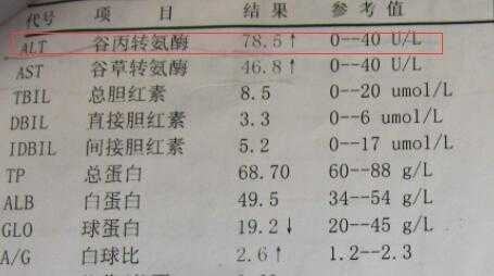 孕期谷丙转氨酶高(孕妇谷丙转氨酶偏高吃什么) 第2张 孕期谷丙转氨酶高(孕妇谷丙转氨酶偏高吃什么) 第2张