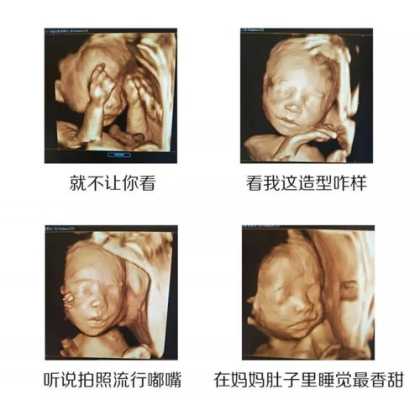 四维彩超是检查什么的,四维主要检查胎儿什么部位 第1张 四维彩超是检查什么的,四维主要检查胎儿什么部位 第1张