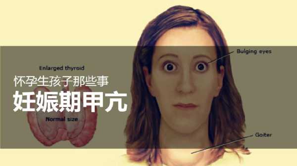 妊娠期甲亢对胎儿影响(孕妇甲亢数值偏高,对胎儿有什么影响) 第2张 妊娠期甲亢对胎儿影响(孕妇甲亢数值偏高,对胎儿有什么影响) 第2张