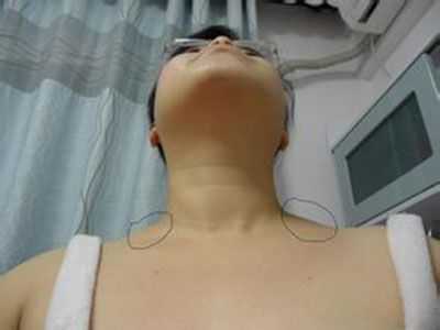 怀孕甲亢的症状有哪些,孕期甲状腺有什么症状表现出来吗?  第2张