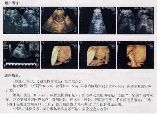 怀孕25周,胎宝头偏大要紧么,胎儿头围偏大是男孩吗还是女孩 第1张 怀孕25周,胎宝头偏大要紧么,胎儿头围偏大是男孩吗还是女孩 第1张