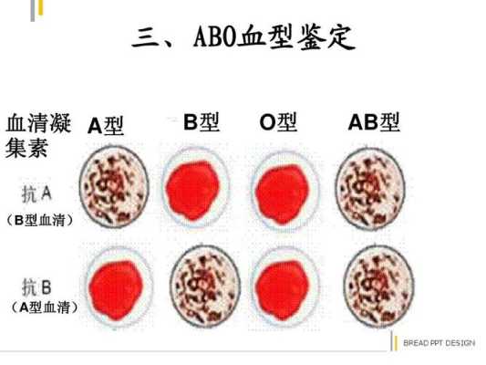 测胎儿血型有几种方法(孕期产检会对血型进行检查吗?一直都不知道自己是什么血型的,或者我可以自己处理呀) 第3张 测胎儿血型有几种方法(孕期产检会对血型进行检查吗?一直都不知道自己是什么血型的,或者我可以自己处理呀) 第3张