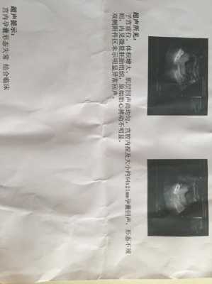 怀孕早期胎心胎芽出现的晚是什么原因造成的,胎心出现晚的孩子健康吗 第2张 怀孕早期胎心胎芽出现的晚是什么原因造成的,胎心出现晚的孩子健康吗 第2张