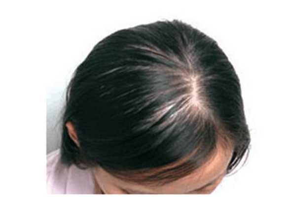 孕妇掉头发厉害的原因有哪些,孕期老掉头发什么原因  第3张