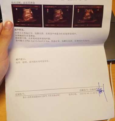 泌尿系统感染的检查方法,胎儿泌尿系统怎么检查最准确  第2张