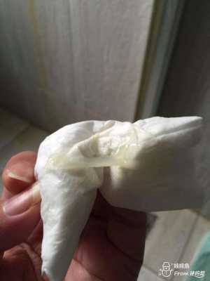 孕期白带粘稠像鼻涕 第2张 孕期白带粘稠像鼻涕 第2张