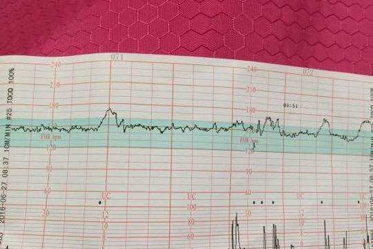 孕38周宫缩频繁胎动多是不是表示小孩快要生了?这段时间需要注意什么呢,b超频繁对胎儿的影响大吗  第1张