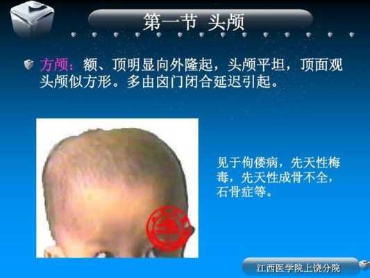 胎儿颅骨呈椭圆形好吗(方颅顶如何判断) 第2张 胎儿颅骨呈椭圆形好吗(方颅顶如何判断) 第2张