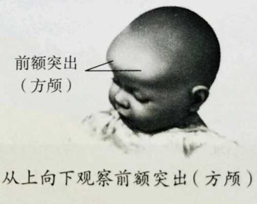 胎儿颅骨呈椭圆形好吗(方颅顶如何判断) 第1张 胎儿颅骨呈椭圆形好吗(方颅顶如何判断) 第1张