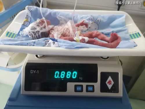 多少克是一斤胎儿(宝宝880克有多少斤) 第2张 多少克是一斤胎儿(宝宝880克有多少斤) 第2张