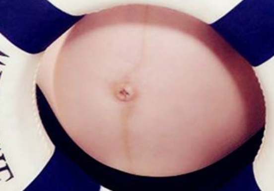 孕期肚子中间的黑线(孕期肚子中间的黑线是什么) 第2张 孕期肚子中间的黑线(孕期肚子中间的黑线是什么) 第2张