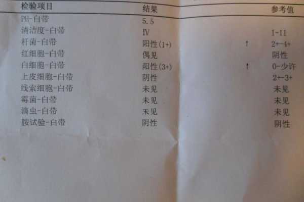 孕妇下身流白色液体正常吗,孕期出现奶白色分泌物 第1张 孕妇下身流白色液体正常吗,孕期出现奶白色分泌物 第1张