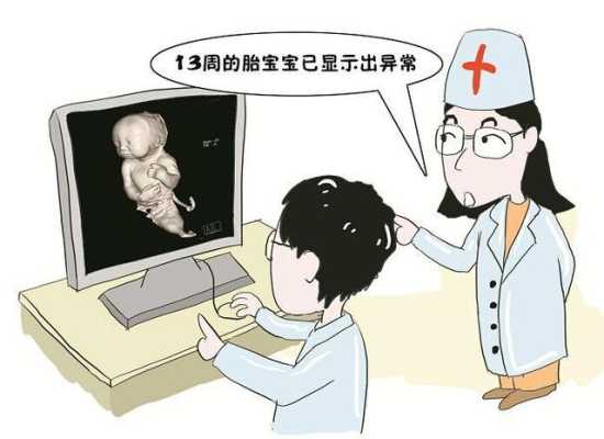胎儿致死性侏儒症原因(胎儿致死性侏儒症原因是什么) 第1张 胎儿致死性侏儒症原因(胎儿致死性侏儒症原因是什么) 第1张