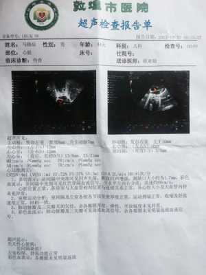 心脏超声检查多少钱,胎儿心脏筛查多少钱一次 第1张 心脏超声检查多少钱,胎儿心脏筛查多少钱一次 第1张