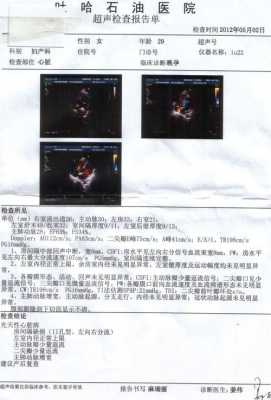 心脏超声检查多少钱,胎儿心脏筛查多少钱一次 第3张 心脏超声检查多少钱,胎儿心脏筛查多少钱一次 第3张