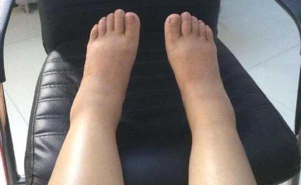 怀孕脚会变大吗为什么呢,孕期脚会变大吗? 第2张 怀孕脚会变大吗为什么呢,孕期脚会变大吗? 第2张