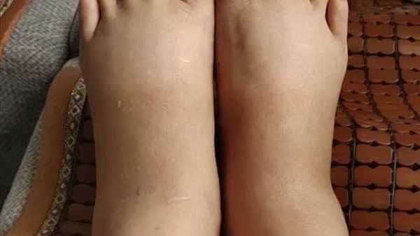 怀孕脚会变大吗为什么呢,孕期脚会变大吗? 第1张 怀孕脚会变大吗为什么呢,孕期脚会变大吗? 第1张