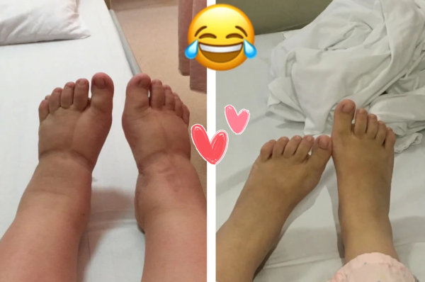怀孕脚会变大吗为什么呢,孕期脚会变大吗? 第3张 怀孕脚会变大吗为什么呢,孕期脚会变大吗? 第3张