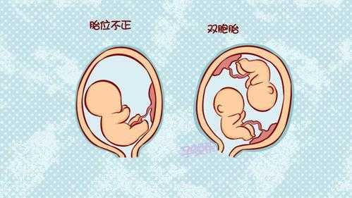 胎儿臂位是什么意思(胎儿臂位是什么样子的) 第2张 胎儿臂位是什么意思(胎儿臂位是什么样子的) 第2张