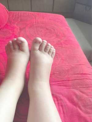 怀孕期间的孕妇,一般什么时候会开始水肿了,孕期什么时候水肿最严重 第2张 怀孕期间的孕妇,一般什么时候会开始水肿了,孕期什么时候水肿最严重 第2张