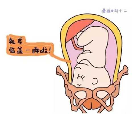 胎位不正胎儿会入盆吗(一般怀孕多少周宝宝入盆) 第2张 胎位不正胎儿会入盆吗(一般怀孕多少周宝宝入盆) 第2张