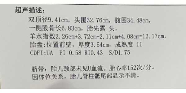 医生摸的胎儿体重准吗(医生摸的胎儿体重准吗怎么看) 第2张 医生摸的胎儿体重准吗(医生摸的胎儿体重准吗怎么看) 第2张