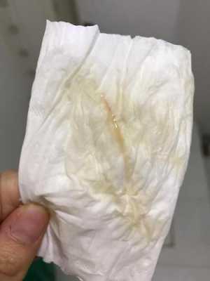 见红会引起胎儿缺氧吗(见红会引起胎儿缺氧吗) 第2张 见红会引起胎儿缺氧吗(见红会引起胎儿缺氧吗) 第2张