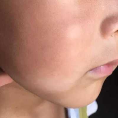 为什么小孩的脸圆的,胎儿头很圆是什么原因造成的 第3张 为什么小孩的脸圆的,胎儿头很圆是什么原因造成的 第3张