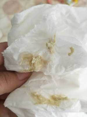 孕期白带发黄粘稠图片(怀孕了白带发黄是怎么回事) 第1张 孕期白带发黄粘稠图片(怀孕了白带发黄是怎么回事) 第1张