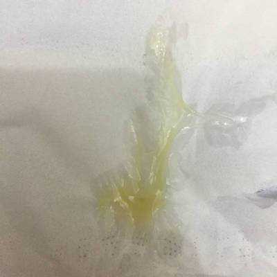 孕期白带发黄粘稠图片(怀孕了白带发黄是怎么回事) 第3张 孕期白带发黄粘稠图片(怀孕了白带发黄是怎么回事) 第3张