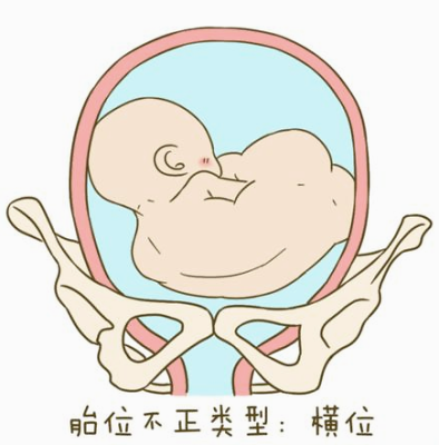 怎么知道宝宝面向你还是背对你,胎儿屁股朝右 第1张 怎么知道宝宝面向你还是背对你,胎儿屁股朝右 第1张