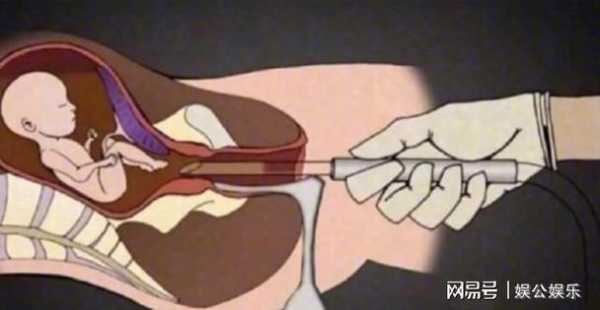 五个月堕胎胎儿图片（姑娘时有，孩子堕胎了二十多年后找人看说是堕胎孩子然后供奉她念佛行吗）  第3张
