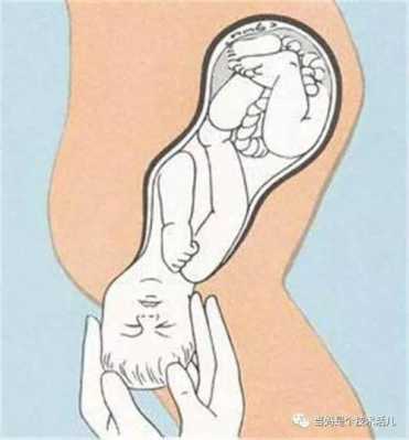 孩子头大能顺产吗,胎儿太大顺产影响大吗视频 第2张 孩子头大能顺产吗,胎儿太大顺产影响大吗视频 第2张