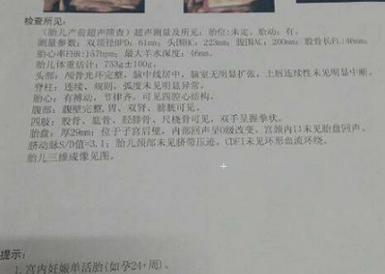 36周胎儿b超数据标准(36周胎儿b超数据标准对照表) 第2张 36周胎儿b超数据标准(36周胎儿b超数据标准对照表) 第2张