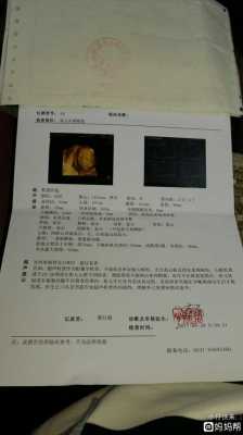 宝宝三维图怎么用ai生成,三维胎儿长相看男女准吗 第1张 宝宝三维图怎么用ai生成,三维胎儿长相看男女准吗 第1张