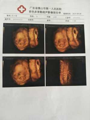 宝宝三维图怎么用ai生成,三维胎儿长相看男女准吗 第2张 宝宝三维图怎么用ai生成,三维胎儿长相看男女准吗 第2张