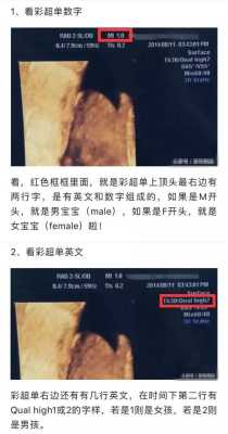 宝宝三维图怎么用ai生成,三维胎儿长相看男女准吗 第3张 宝宝三维图怎么用ai生成,三维胎儿长相看男女准吗 第3张