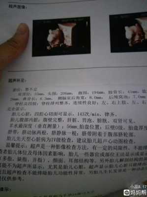 四维胎儿肠道回声增强(四维胎儿肠道回声增强怎么办) 第1张 四维胎儿肠道回声增强(四维胎儿肠道回声增强怎么办) 第1张