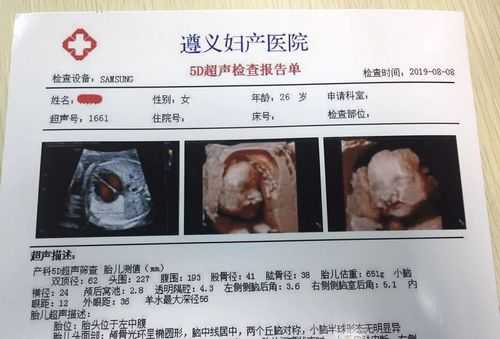 胎儿5d彩超图片(临汾有5d彩超么) 第2张 胎儿5d彩超图片(临汾有5d彩超么) 第2张