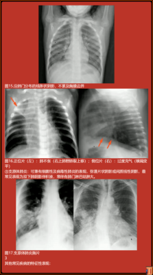 一次胸片不会影响胎儿(一次胸片不会影响胎儿) 第2张 一次胸片不会影响胎儿(一次胸片不会影响胎儿) 第2张