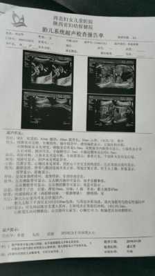 先天性肺囊腺瘤会变小吗,胎儿左肺囊腺瘤怎么办能治好吗 第2张 先天性肺囊腺瘤会变小吗,胎儿左肺囊腺瘤怎么办能治好吗 第2张
