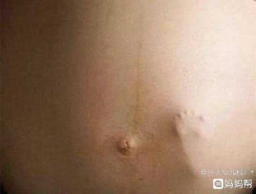 36周胎儿生下来会怎样(36周宫缩频繁还带疼痛会不会早产?36周的胎儿一般有多重) 第3张 36周胎儿生下来会怎样(36周宫缩频繁还带疼痛会不会早产?36周的胎儿一般有多重) 第3张