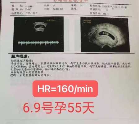 孕期胎心多少正常(孕期胎心多少正常范围) 第3张 孕期胎心多少正常(孕期胎心多少正常范围) 第3张