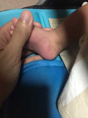 胎儿脚在右侧是男是女(一岁宝宝走路两只脚不一样) 第2张 胎儿脚在右侧是男是女(一岁宝宝走路两只脚不一样) 第2张